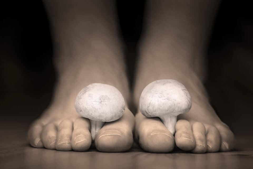 5 Causes of Black Toenails - Feet First Clinic