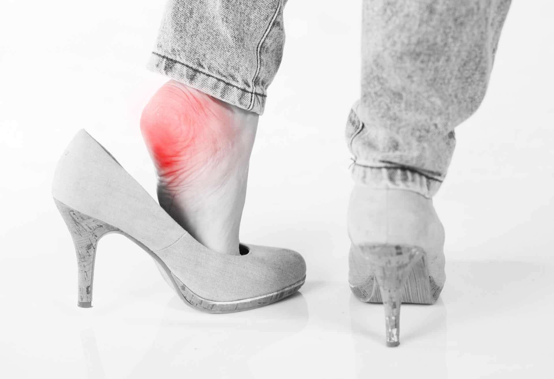 Female pain in heel wearing high heels