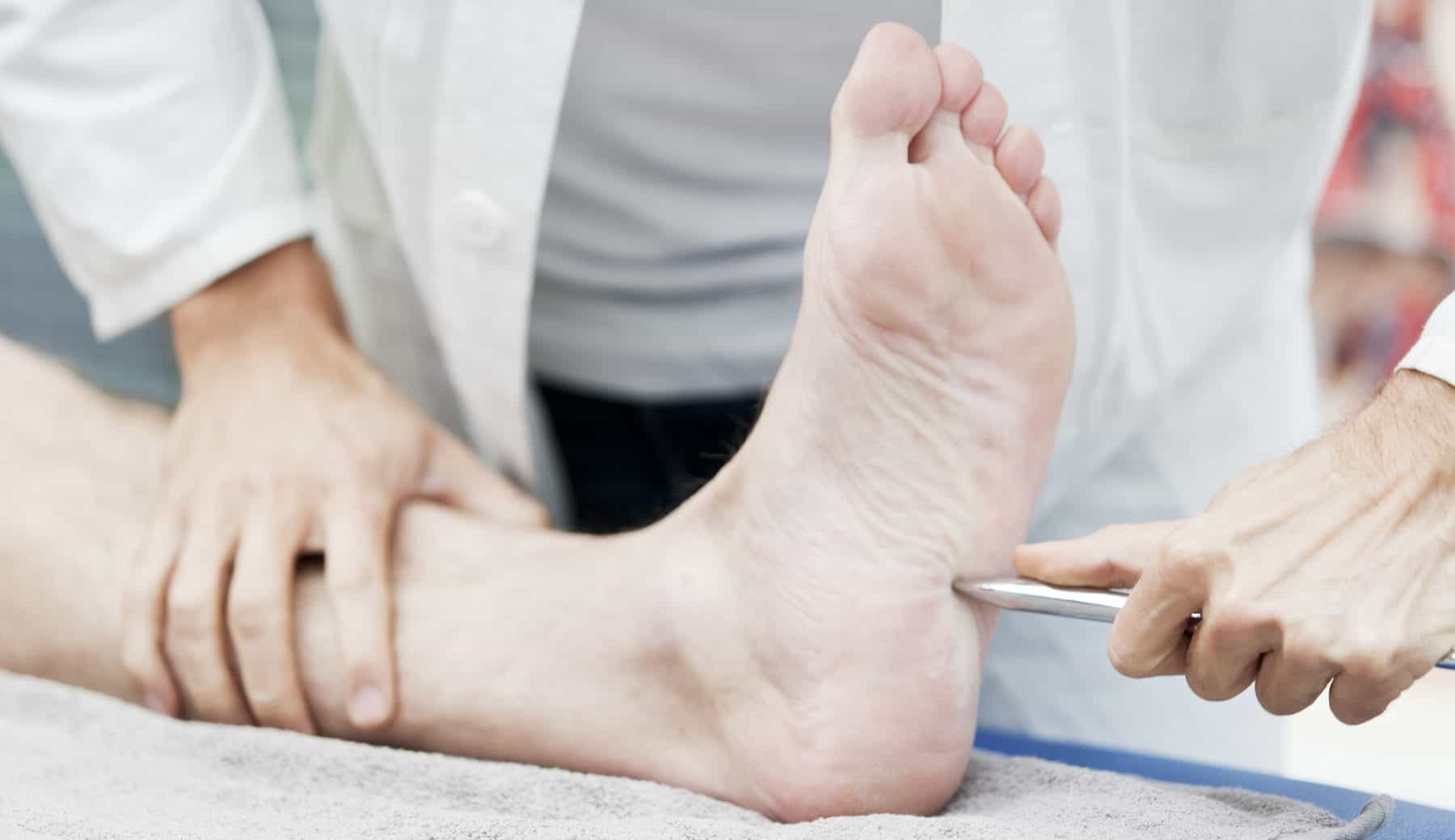 Doctor testing Babinski reflex