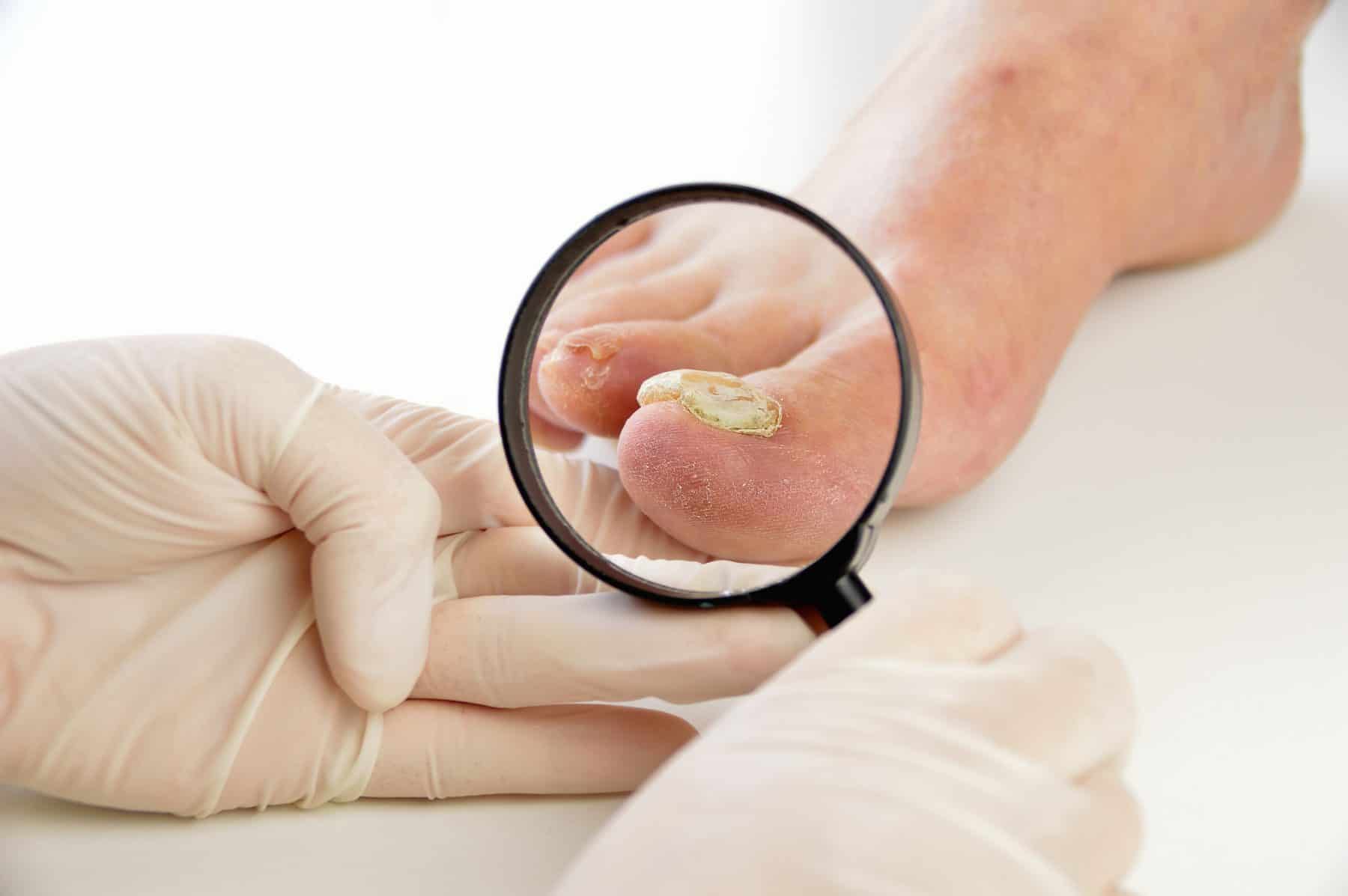 podologist checking the patient foot