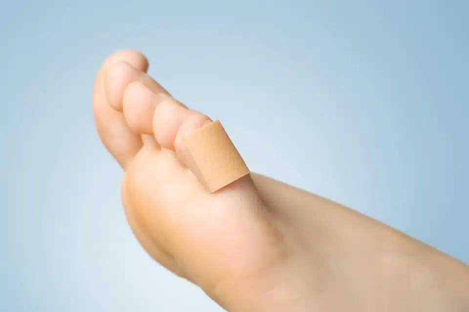 side view of bottom of foot and toes with bandaid wrapped around pinky toe