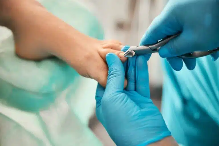 Toenail clipping during medical pedicure