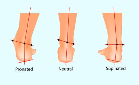 How to Treat a Cracked Toenail - Feet First Clinic