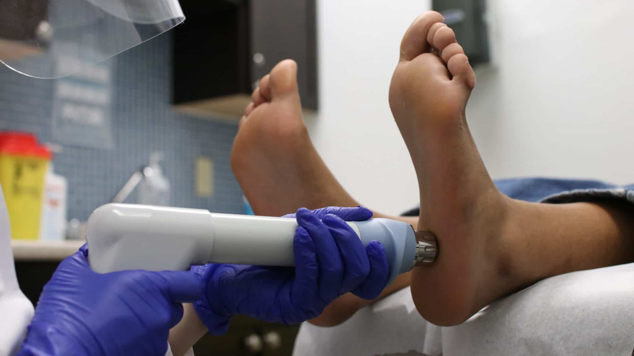 What to Expect During Shockwave Therapy Feet First Clinic