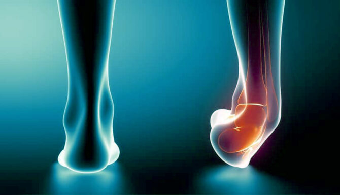 blue and black image of two feet one with a rolled ankle and red insides depicting ankle sprain